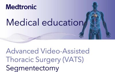 Advanced VATS Segmentectomy Workshop