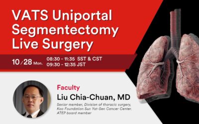 VATS Uniportal Segmentectomy Live Surgery